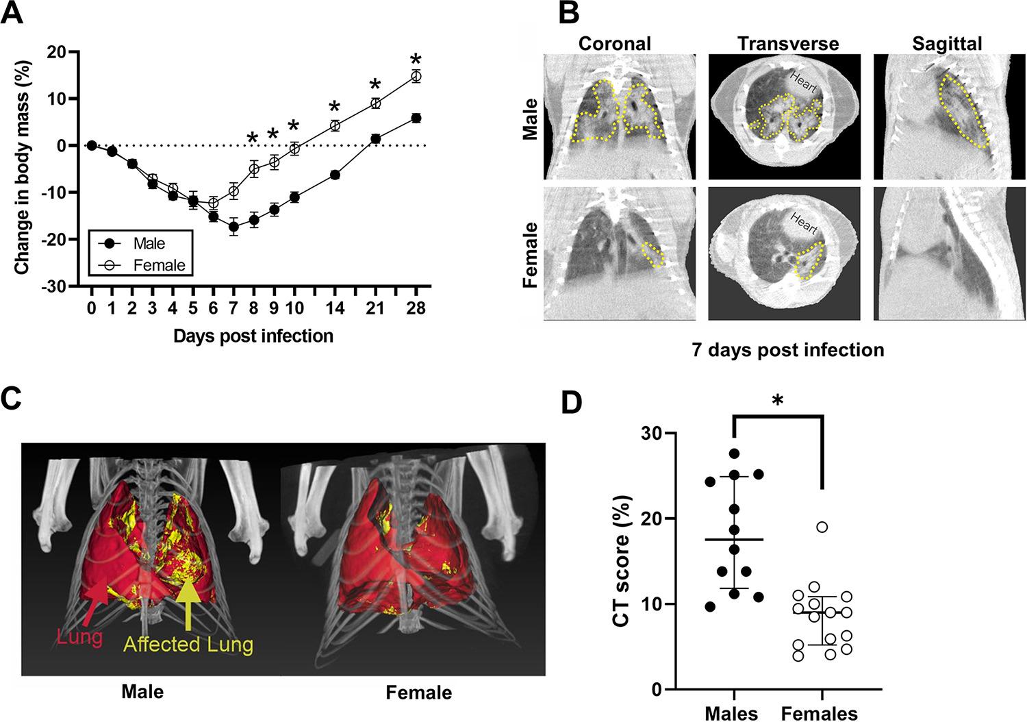 Mediso Sex Differences In Lung Imaging And Sars Cov 2 Antibody